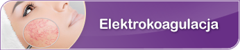 Elektrokoagulacja